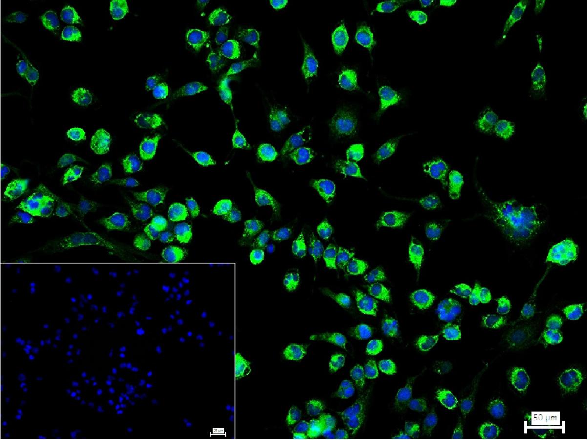 Ⅲ型胶原蛋白/胶原蛋白3/3型胶原蛋白抗体-bs-0948R