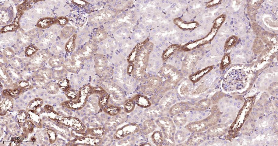 丝裂原活化蛋白激酶激酶1/2重组兔单抗