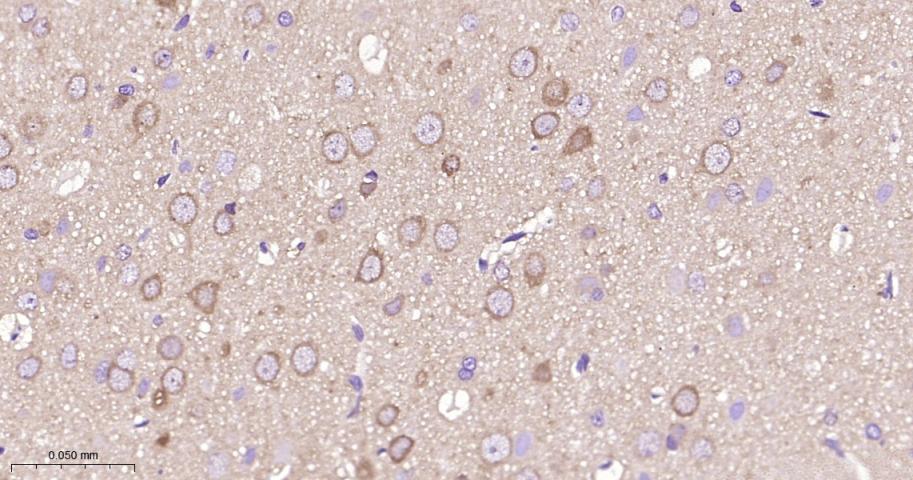 丝裂原活化蛋白激酶激酶1/2重组兔单抗