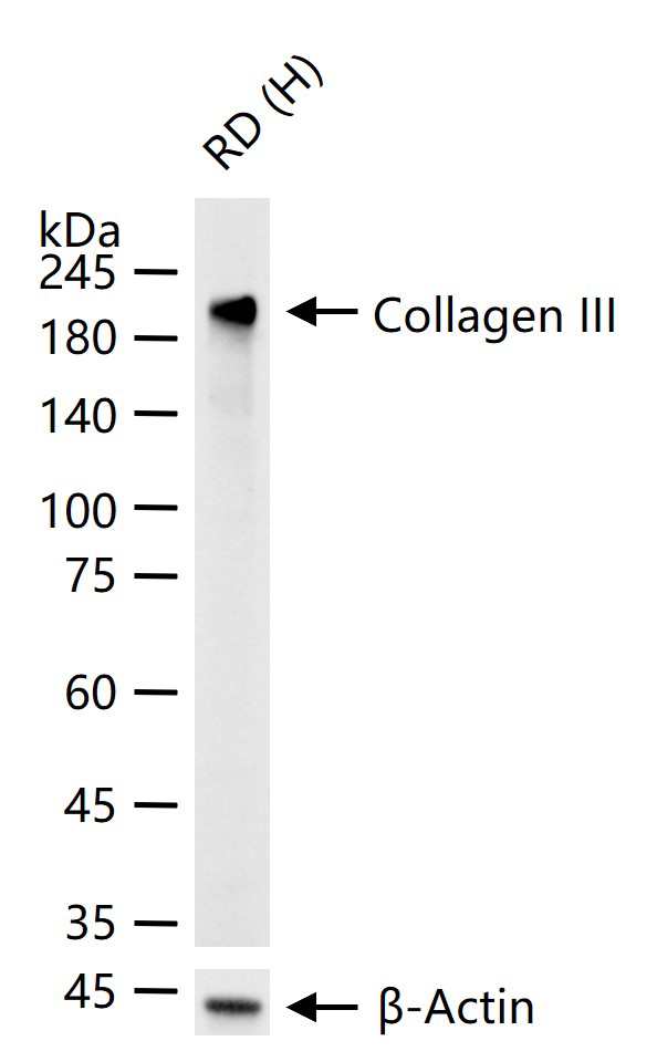 Ⅲ型胶原蛋白重组兔单抗