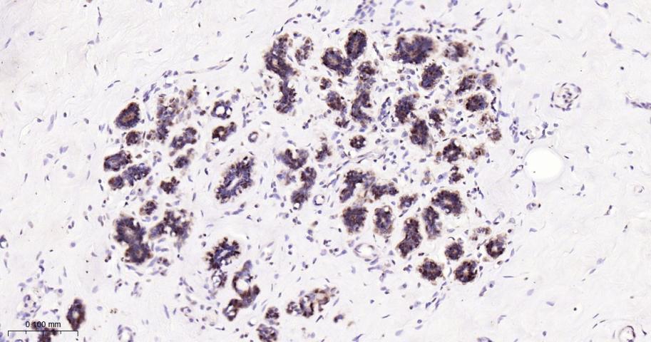 环指蛋白75重组兔单抗