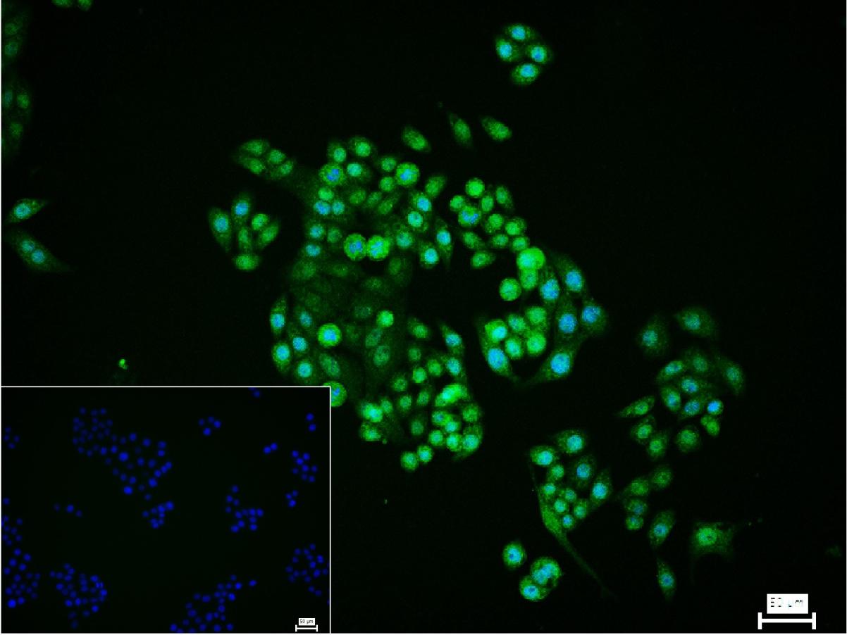 端粒结合蛋白2重组兔单抗