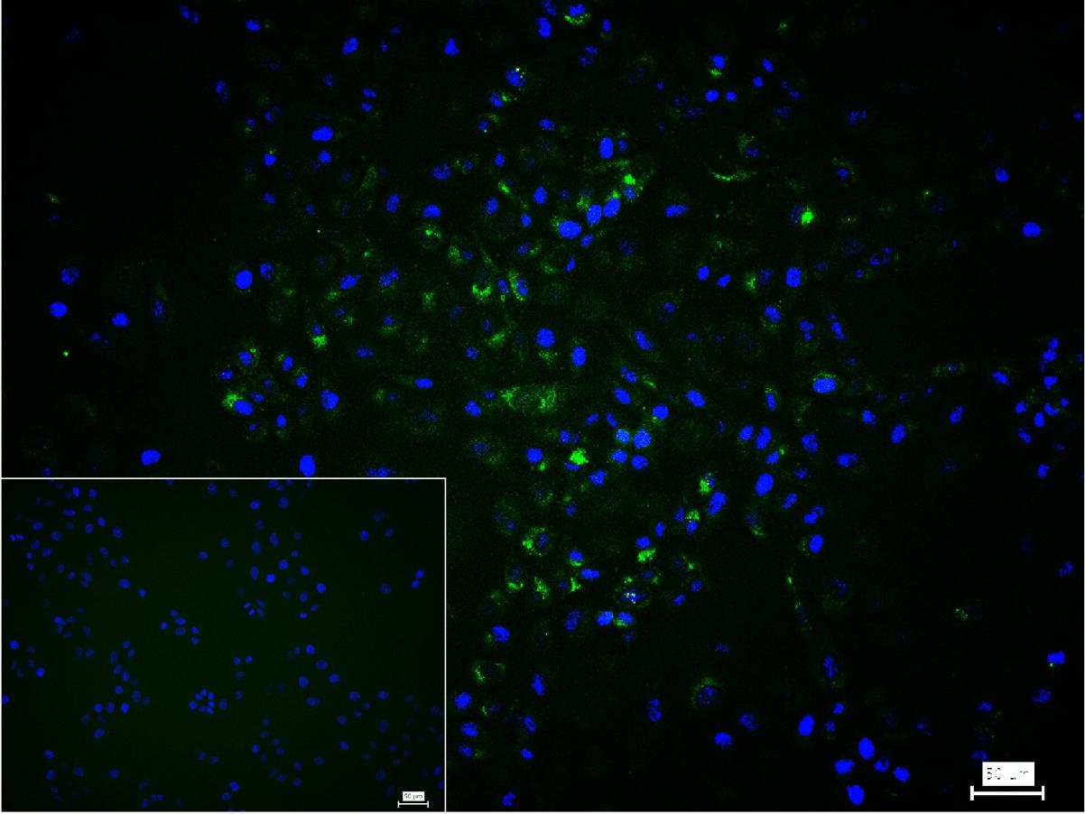 I型胶原蛋白/胶原蛋白1/1型胶原蛋白/I型胶原a1抗体