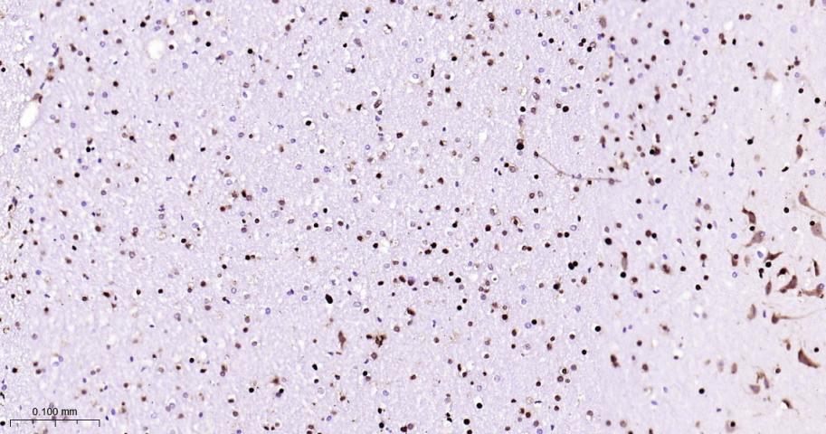 核仁蛋白C23重组兔单抗-bsm-62918R