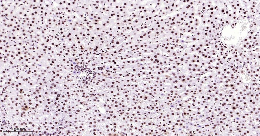 核仁蛋白C23重组兔单抗-bsm-62918R