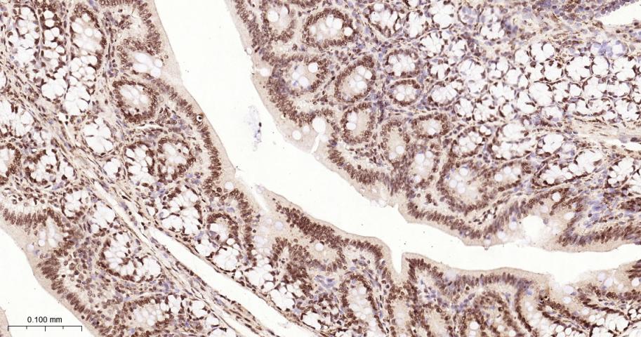 组蛋白H2A重组兔单抗