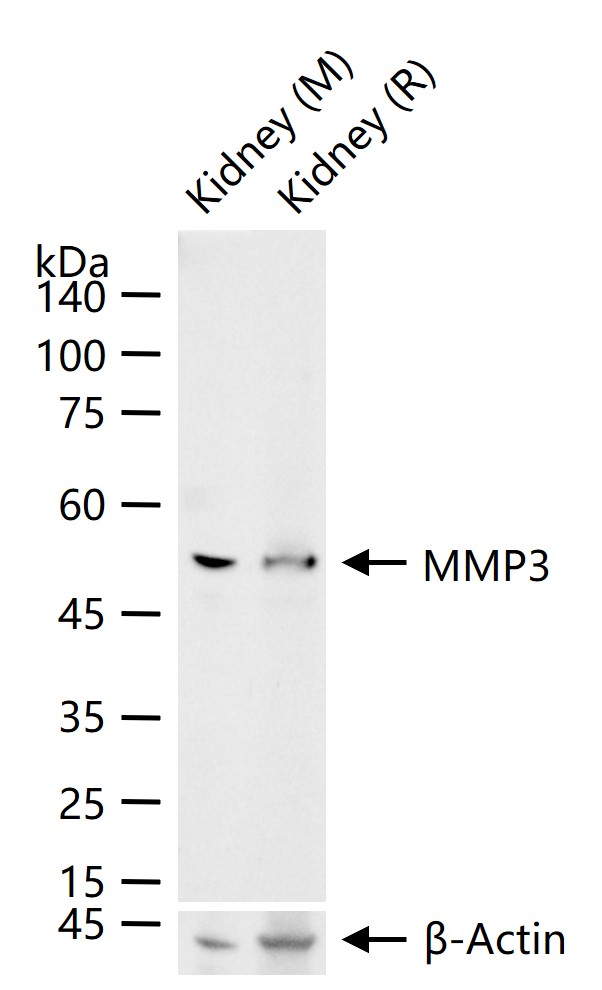 基质金属蛋白酶3重组兔单抗