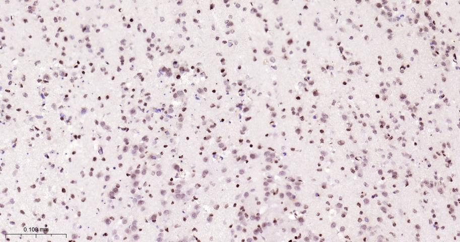 组蛋白H2A重组兔单抗