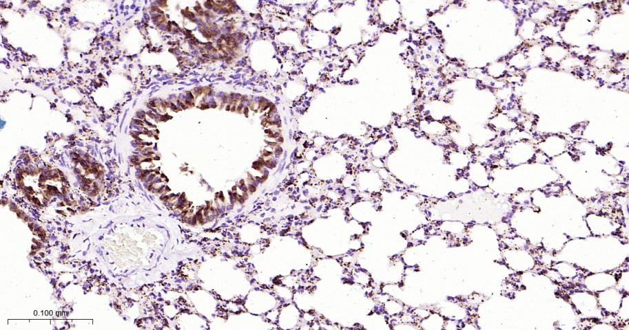 组织蛋白酶L/V/K/H重组兔单抗