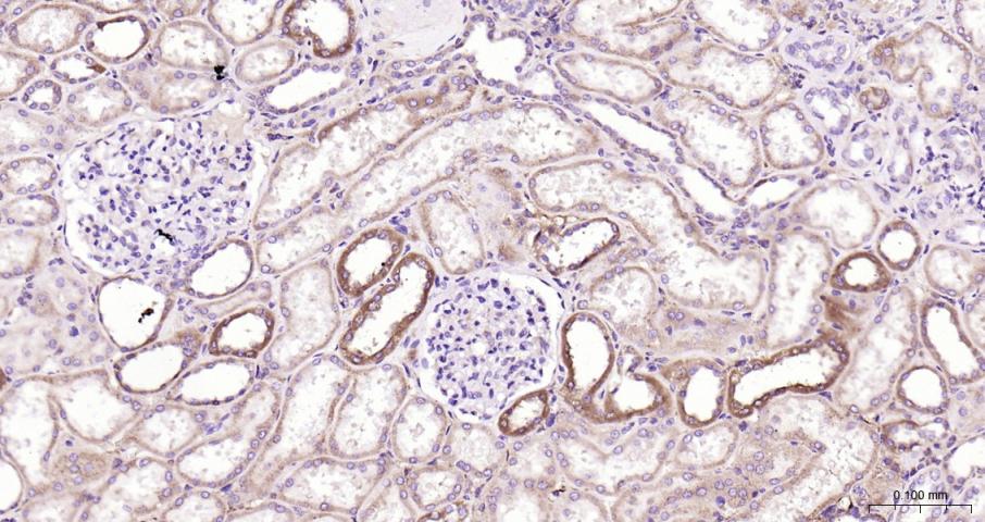 Bcl-xL蛋白抗体-bs-25848R