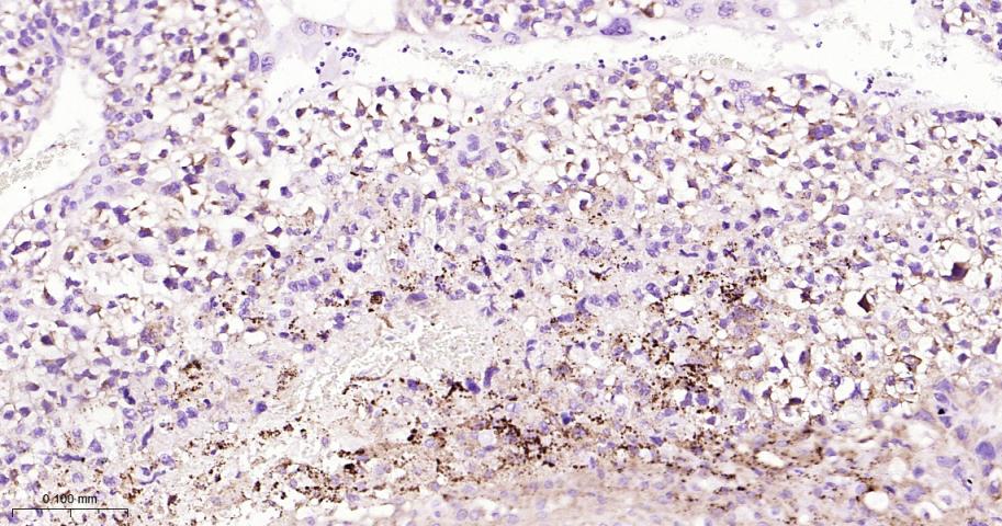 组织蛋白酶L/V/K/H重组兔单抗