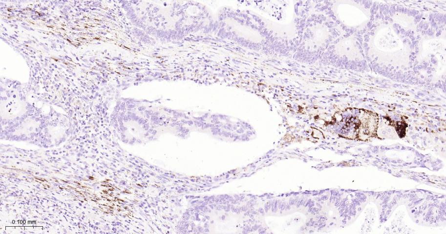组织蛋白酶L/V/K/H重组兔单抗