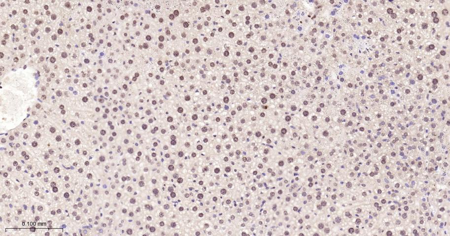 组蛋白H2A重组兔单抗