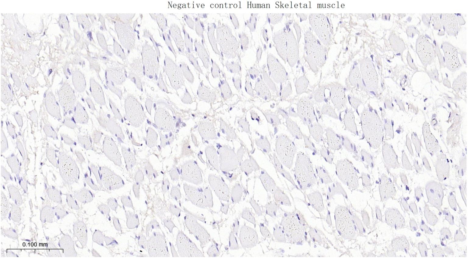 多配体蛋白聚糖1（CD138）重组兔单抗