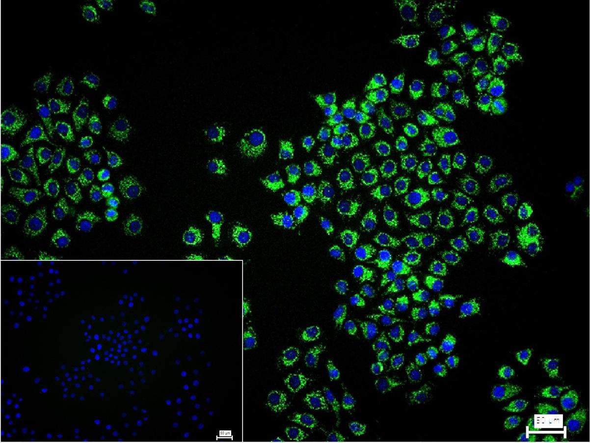 等电压依赖性阴离子通道（内参）重组兔单抗