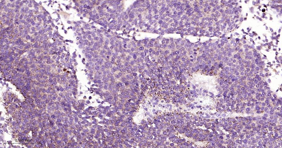 组织蛋白酶L/V/K/H重组兔单抗