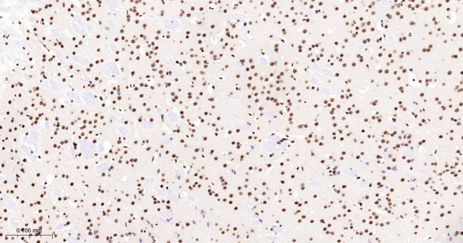 组蛋白H2A重组兔单抗