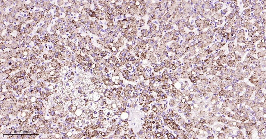 组织蛋白酶L/V/K/H重组兔单抗