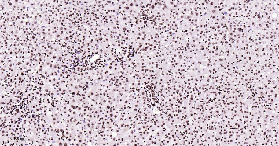 核仁蛋白C23重组兔单抗-bsm-62918R