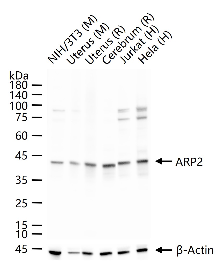 肌动蛋白相关蛋白2重组兔单抗