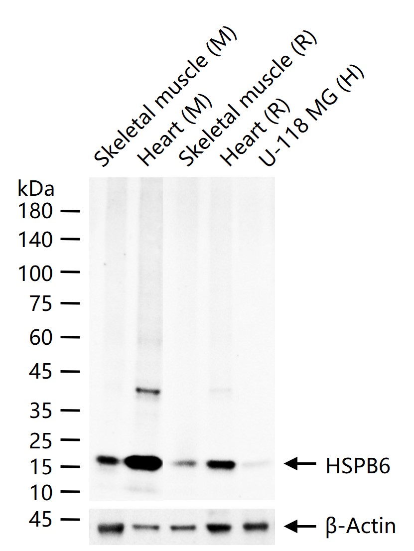 热休克蛋白-20重组兔单抗