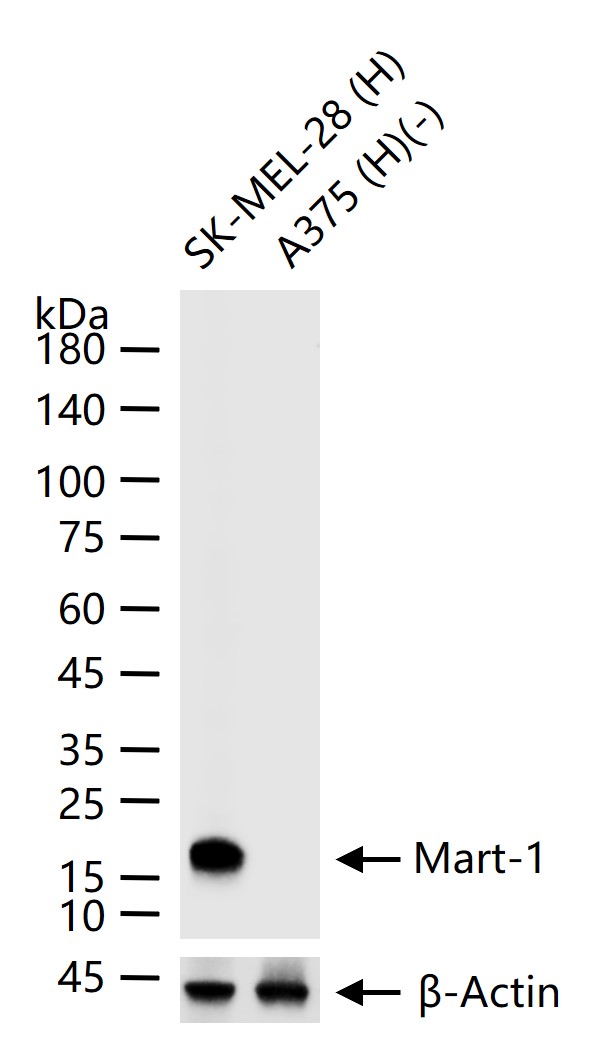 Mart-1 Mouse mAb (一抗) - WB,IHC-P,IHC-F,IF | Bioss