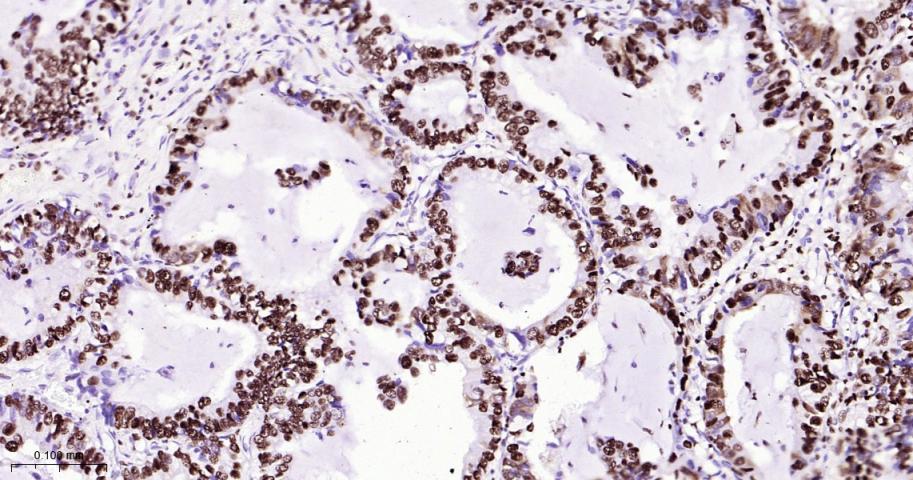 核仁蛋白C23重组兔单抗-bsm-62918R