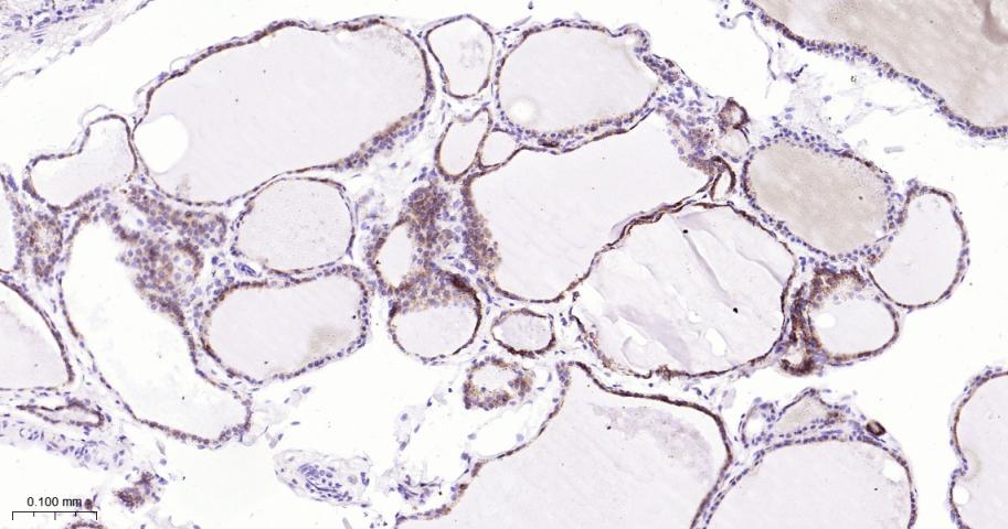 组织蛋白酶L/V/K/H重组兔单抗