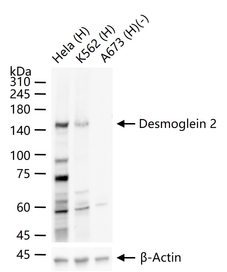 兔抗桥粒芯糖蛋白2单克隆抗体