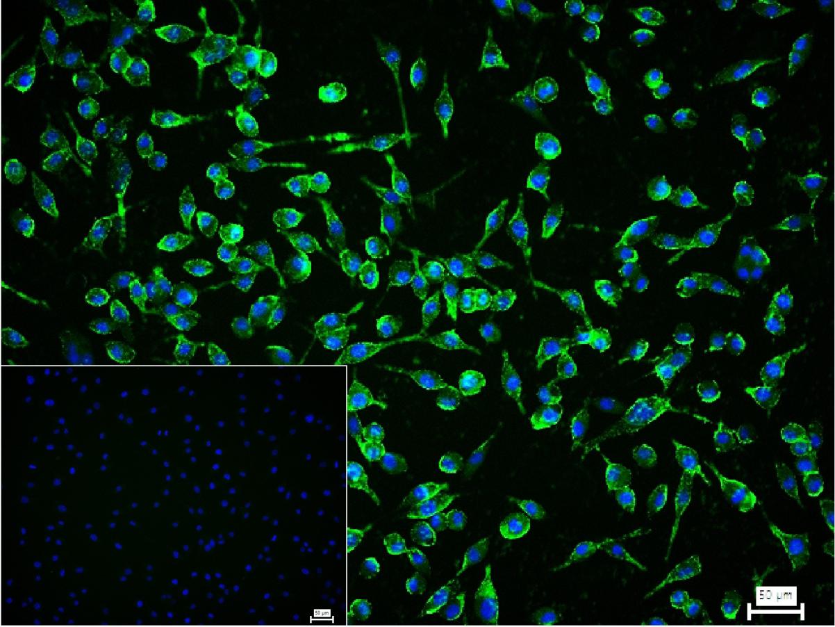 周期素依赖性激酶5重组兔单抗