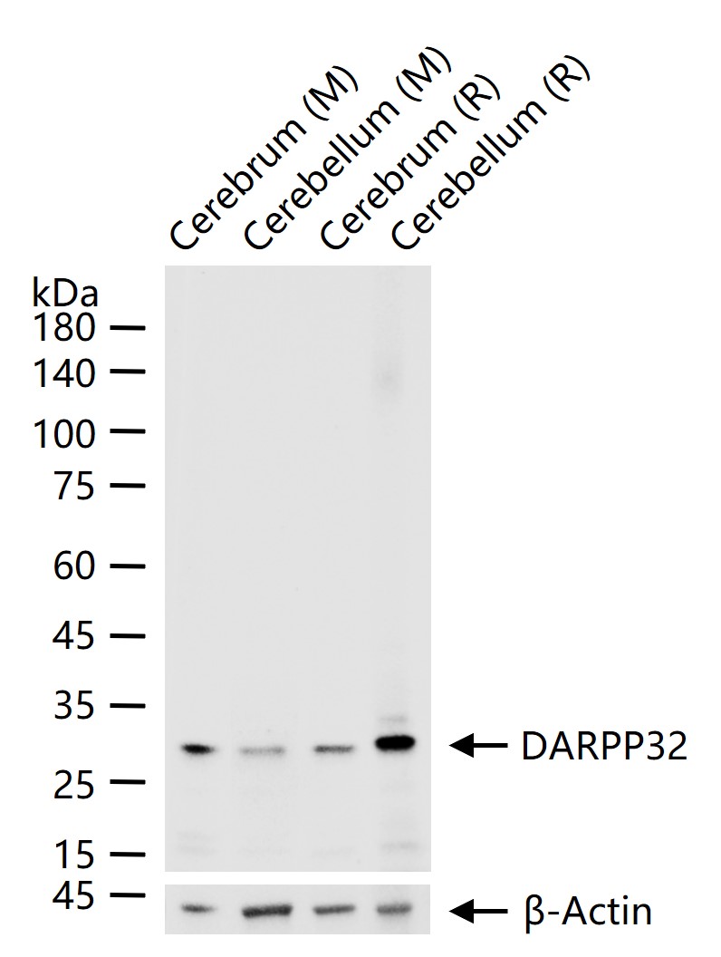 多巴胺/cAMP调节神经磷蛋白重组兔单抗
