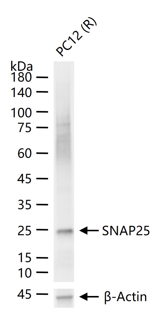 突触相关蛋白25重组兔单抗