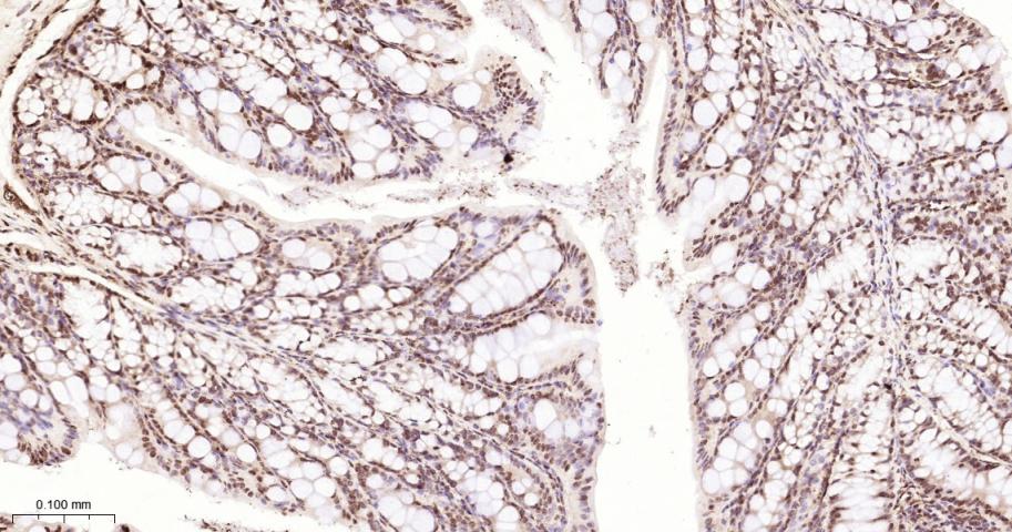 组蛋白H2A重组兔单抗