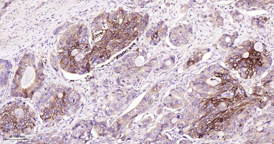 Bcl-xL蛋白抗体-bs-25848R