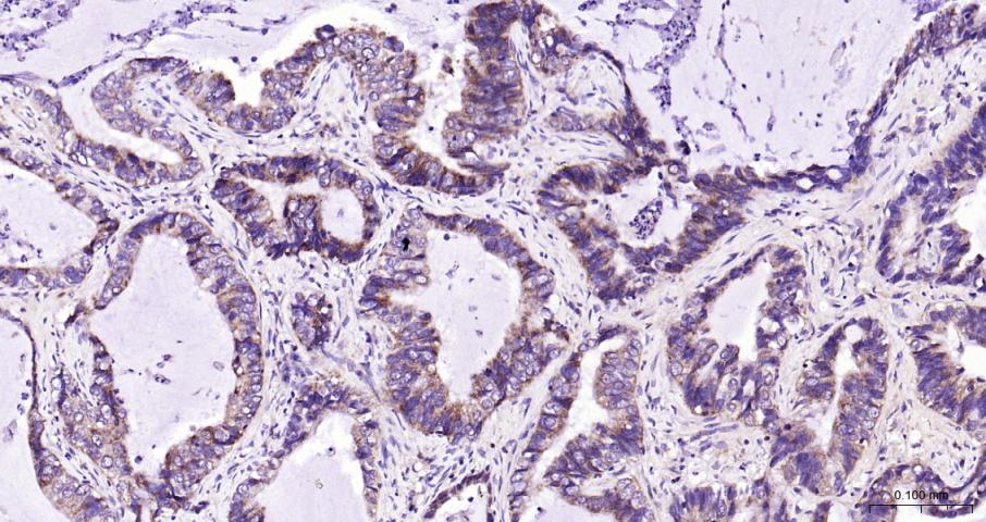 Bcl-xL蛋白抗体-bs-25848R