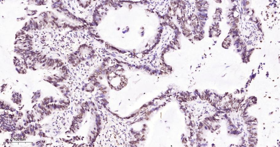 组蛋白H2A重组兔单抗