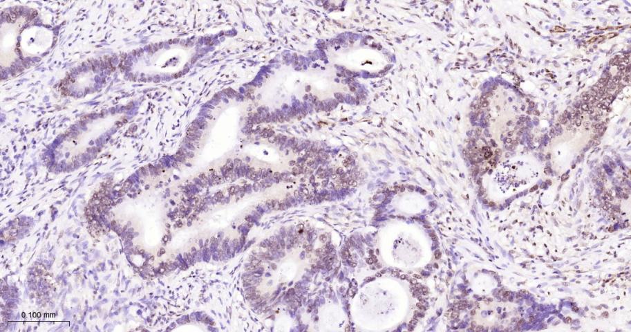 组蛋白H2A重组兔单抗