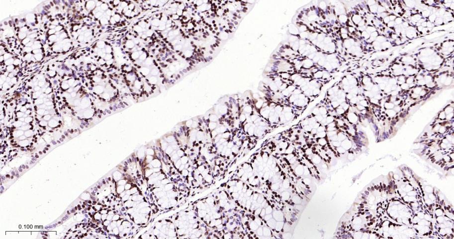 核仁蛋白C23重组兔单抗-bsm-62918R