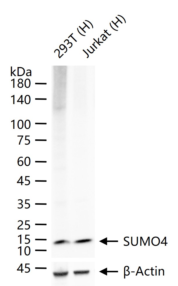 小泛素样修饰蛋白4重组兔单抗