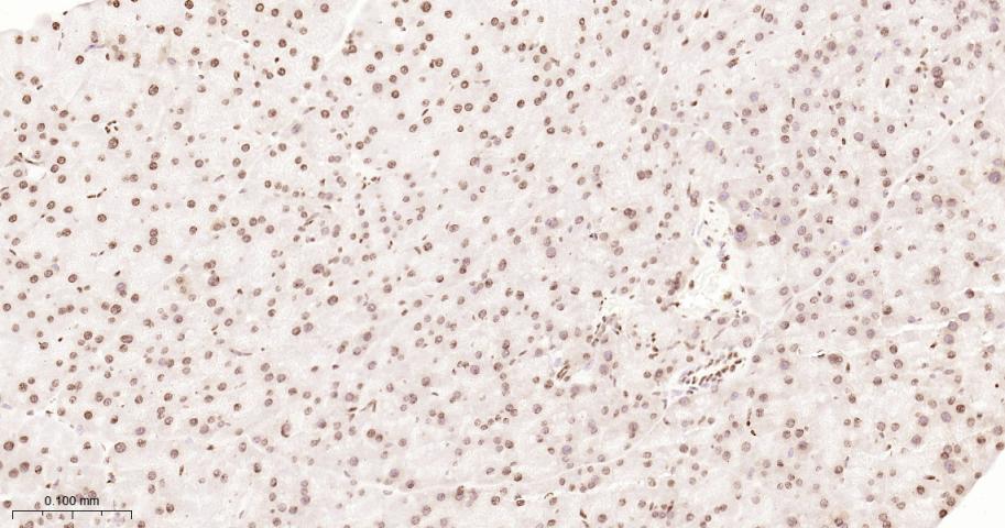 组蛋白H2A重组兔单抗