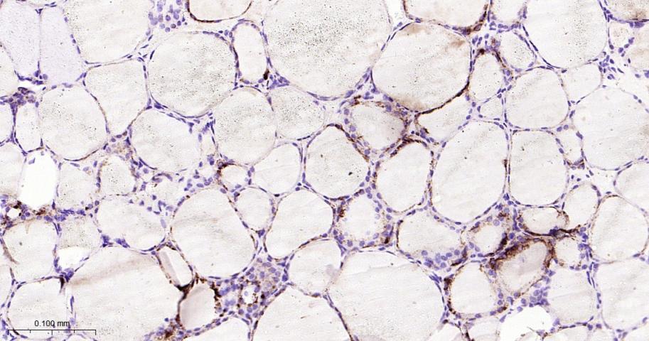 组织蛋白酶L/V/K/H重组兔单抗