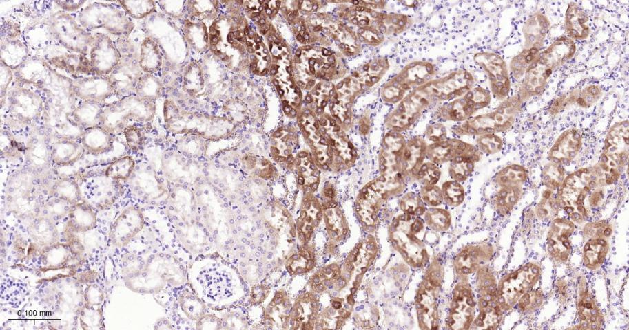 组织蛋白酶L/V/K/H重组兔单抗