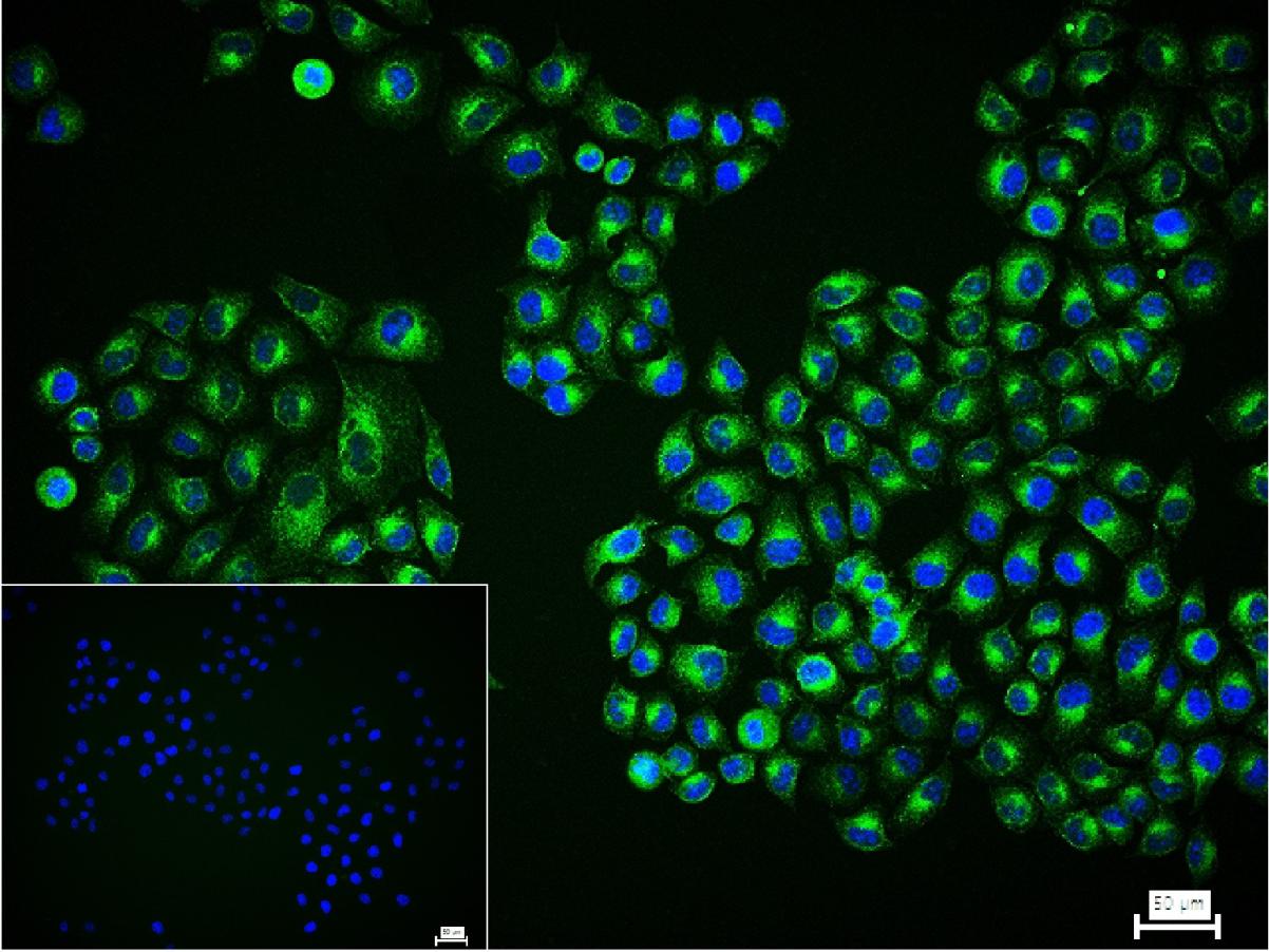 Bcl-2单克隆抗体