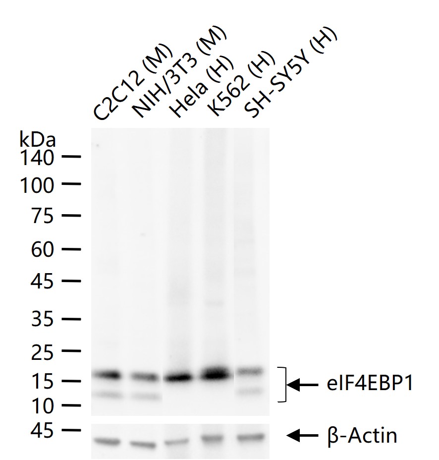 eIF4E结合蛋白重组兔单抗