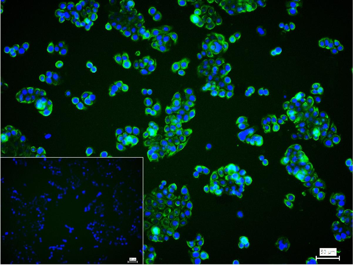 细胞角蛋白20重组兔单抗