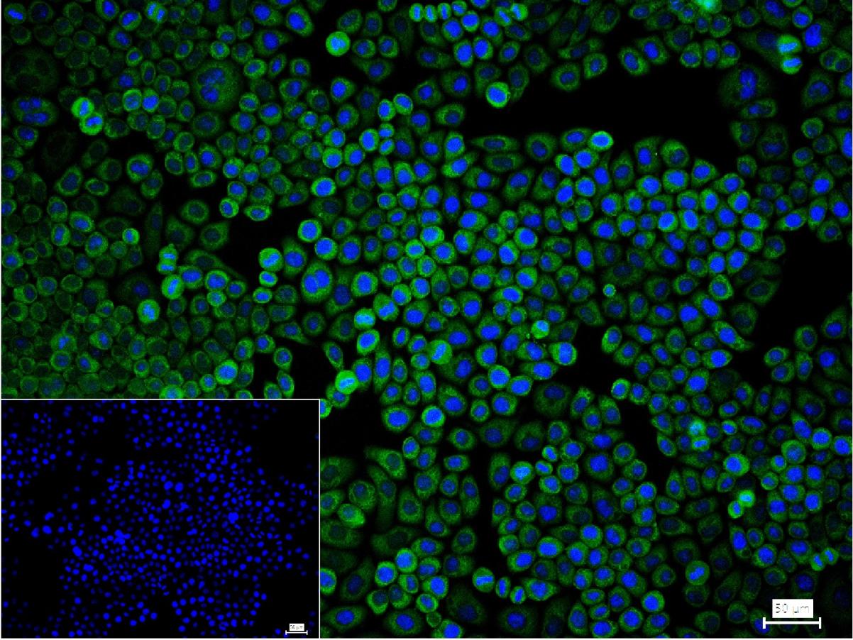 细胞角蛋白16重组兔单抗