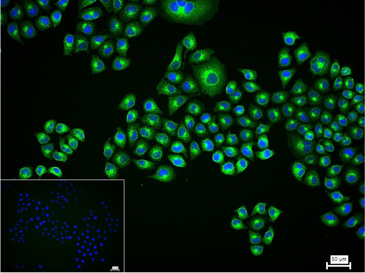 Bcl-2单克隆抗体-bsm-30235M