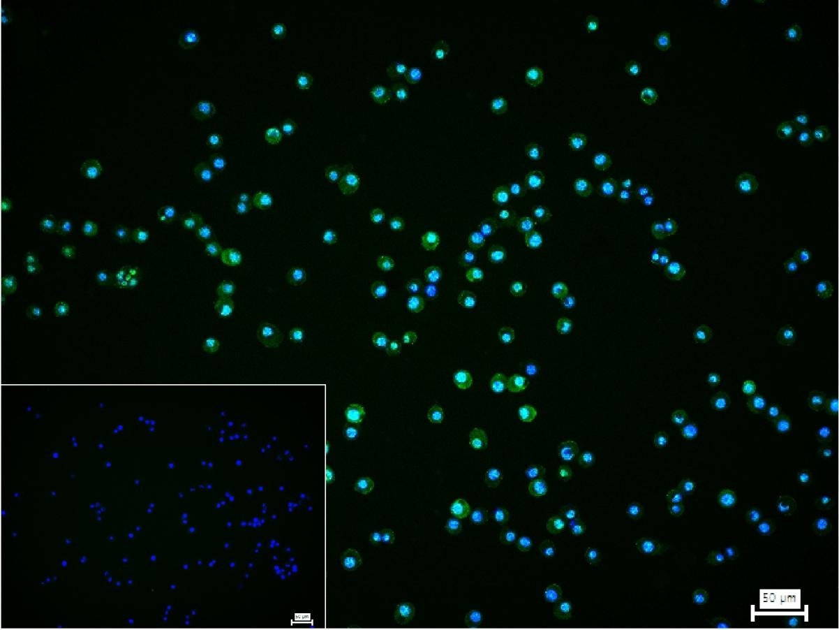 磷酸化MLKL重组兔单抗