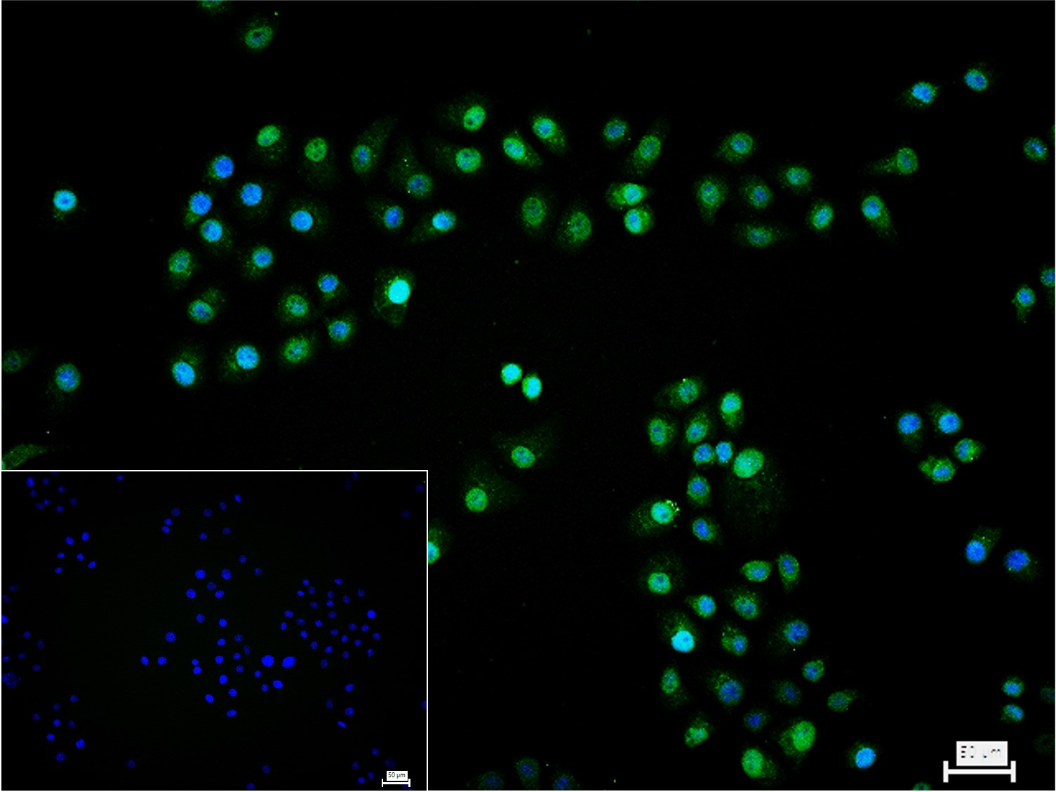 缺氧诱导因子1α /低氧诱导因子-1抗体-bs-42326R