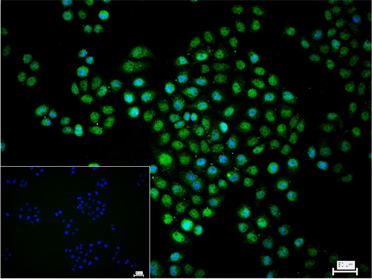 缺氧诱导因子1α /低氧诱导因子-1抗体-bs-42326R